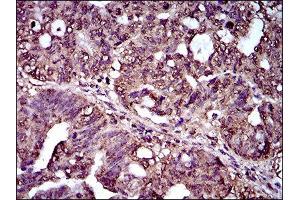 Immunohistochemistry (IHC) image for anti-Interleukin 2 Receptor, alpha (IL2RA) (AA 34-139) antibody (ABIN1845343)