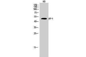 Western Blotting (WB) image for anti-Jun Proto-Oncogene (JUN) (Ser661) antibody (ABIN3183303) (C-JUN anticorps  (Ser661))