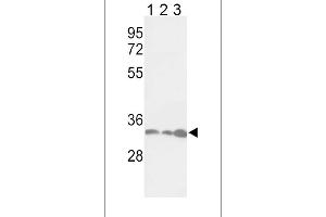 Western blot analysis of PCNA Antibody (Center) (ABIN389345 and ABIN2839454) in Jurkat(lane 1), Hela(lane 2), 293(lane 3) cell line lysates (35 μg/lane). (PCNA anticorps  (AA 89-117))