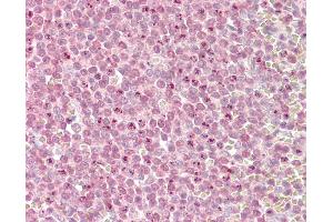 Anti-MLL2 antibody IHC of human spleen. (MLL2 anticorps  (AA 2-14))
