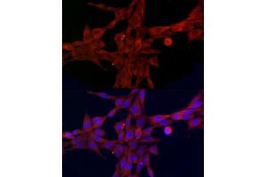 Immunofluorescence analysis of NIH/3T3 cells using SLC27 Rabbit pAb (2847) at dilution of 1:100 (40x lens). (SLC27A1 anticorps  (AA 347-646))