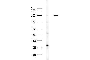 anti-DEAD (Asp-Glu-Ala-Asp) Box Polypeptide 54 (DDX54) (Internal Region) antibody