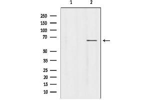 anti-Ubiquitin Specific Peptidase 39 (USP39) (N-Term) antibody