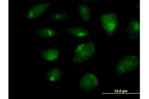 Immunofluorescence of purified MaxPab antibody to CARD9 on HeLa cell.