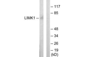 Western Blotting (WB) image for anti-LIM Domain Kinase 1 (LIMK1) (Internal Region) antibody (ABIN1849454) (LIM Domain Kinase 1 anticorps  (Internal Region))