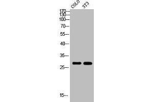 Western Blot analysis of COLO NIH-3T3 cells using Rab 6A Polyclonal Antibody (RAB6A anticorps  (Internal Region))