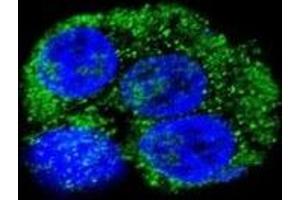 Confocal immunofluorescent analysis of CD36 antibody with HepG2 cells followed by Alexa Fluor 488-conjugated goat anti-rabbit lgG (green).