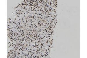 anti-Jun B Proto-Oncogene (JUNB) (pThr102), (pThr104) antibody
