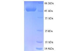 SDS-PAGE (SDS) image for Cysteine-Rich, Angiogenic Inducer, 61 (CYR61) (AA 25-379) protein (His tag) (ABIN5713392)