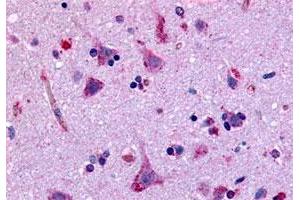 Immunohistochemistry (Formalin/PFA-fixed paraffin-embedded sections) of human brain, neurons and glia with GPR45 polyclonal antibody . (GPR45 anticorps  (Extracellular Domain))
