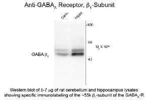 Western Blot of Anti-GABA(A) Receptor beta 1 (Rabbit) Antibody - 612-401-D49 Western Blot of Rabbit anti-GABA(A) Receptor beta 1 antibody. (GABRB1 anticorps  (Cytoplasmic Loop))