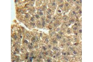 Used in DAB staining on fromalin fixed paraffin-embedded Liver tissue