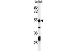 Western blot analysis of PRUNE (arrow) in Jurkat cell line lysates (35ug/lane) using PRUNE  Antibody (C-term). (PRUNE anticorps  (C-Term))