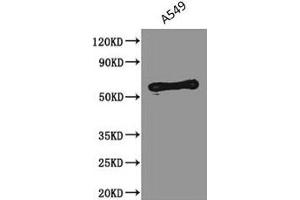 Western Blot Positive WB detected in: A549 whole cell lysate All lanes: PODXL antibody at 2.