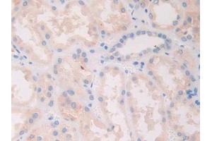 Detection of Slit1 in Human Kidney Tissue using Polyclonal Antibody to Slit Homolog 1 (Slit1)