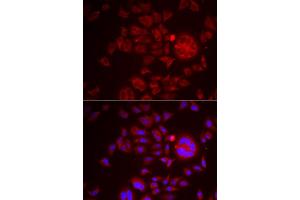 Immunofluorescence analysis of HeLa cells using SPINT1 antibody (ABIN6131743, ABIN6148359, ABIN6148360 and ABIN6222046). (SPINT1 anticorps  (AA 234-513))