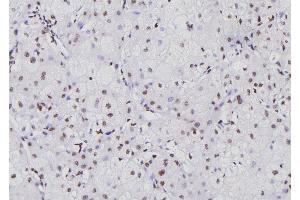 ABIN6276711 at 1/100 staining Human liver tissue by IHC-P. (NFATC1 anticorps  (Internal Region))