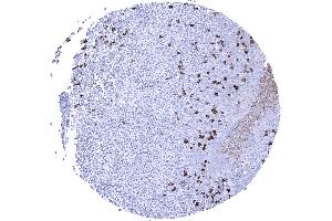 IgA positive plasma cells are numerous in the tonsil (Recombinant Lapin anti-Humain IgA Anticorps)