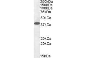 ABIN335145 (0. (EPM2A anticorps  (Internal Region))
