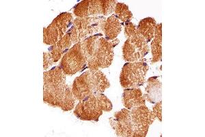 Paraformaldehyde-fixed, paraffin embedded Human skeletal muscle tissue, Antigen retrieval by boiling in sodium citrate buffer (pH6.