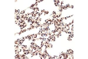 Immunohistochemistry of paraffin-embedded rat lung using CIRBP Rabbit mAb (ABIN7266452) at dilution of 1:100 (40x lens).