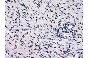Immunohistochemical staining of paraffin-embedded colon tissue using anti-RPA2 mouse monoclonal antibody. (RPA2 anticorps)
