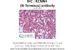 Image no. 1 for anti-Potassium Intermediate/small Conductance Calcium-Activated Channel, Subfamily N, Member 4 (KCNN4) (N-Term) antibody (ABIN1736196) (KCNN4 anticorps  (N-Term))
