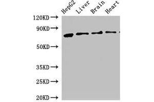 Western Blot Positive WB detected in: HepG2 whole cell lysate, Rat liver tissue, Rat brain tissue, Mouse heart tissue All lanes: KLKB1 antibody at 2. (KLKB1 anticorps  (AA 503-612))