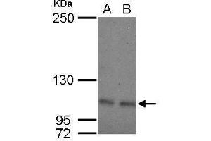 WB Image Sample (30 ug of whole cell lysate) A: 293T B: A431 5% SDS PAGE antibody diluted at 1:500 (OCRL anticorps  (C-Term))