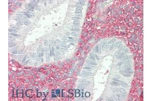 IHC-P analysis of Human Uterus Tissue, with HE staining. (Versican anticorps  (AA 2958-3209))