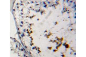 Used in DAB staining on fromalin fixed paraffin- embedded testis tissue (PRM2 anticorps  (AA 2-100))