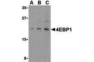 Western Blotting (WB) image for anti-Eukaryotic Translation Initiation Factor 4E Binding Protein 1 (EIF4EBP1) (C-Term) antibody (ABIN1030211) (eIF4EBP1 anticorps  (C-Term))
