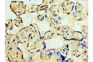 Immunohistochemistry of paraffin-embedded human placenta tissue using ABIN7148860 at dilution of 1:100 (CDK16 anticorps  (AA 277-496))