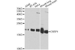 Western blot analysis of extracts of various cell lines, using CSRP1 Antibody (ABIN5970430) at 1/1000 dilution.