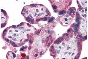 Human Placenta: Formalin-Fixed, Paraffin-Embedded (FFPE)