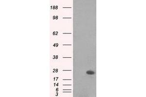 Image no. 1 for anti-MAD2 Mitotic Arrest Deficient-Like 1 (Yeast) (MAD2L1) antibody (ABIN1499249)