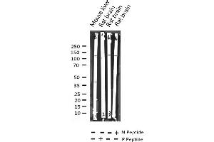 Western blot analysis of Phospho-HDAC4 (Ser632) expression in various lysates