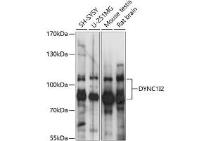 Western blot analysis of extracts of various cell lines, using DYNC1I2 antibody (ABIN7266862) at 1:1000 dilution. (DYNC1I2 anticorps  (AA 352-612))