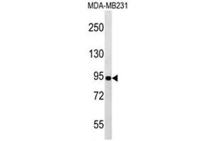 Western blot analysis of POU6F2 Antibody (N-term) in MDA-MB231 cell line lysates (35ug/lane). (POU6F2 anticorps  (N-Term))