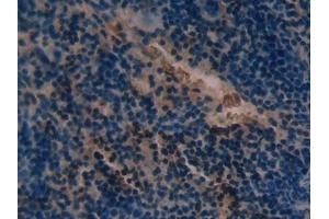 Detection of SOD2 in Mouse Spleen Tissue using Polyclonal Antibody to Superoxide Dismutase 2, Mitochondrial (SOD2)