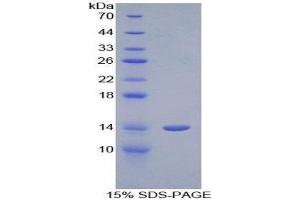 SDS-PAGE (SDS) image for Cystatin-Like 1 (CSTL1) (AA 21-114) protein (His tag) (ABIN1079332) (CSTL1 Protein (AA 21-114) (His tag))