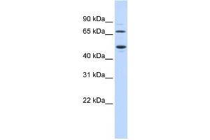 Western Blotting (WB) image for anti-Tryptophan 2,3-Dioxygenase (TDO2) antibody (ABIN2458954) (TDO2 anticorps)