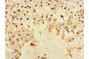 Immunohistochemistry of paraffin-embedded human placenta tissue using ABIN7150861 at dilution of 1:100 (DNAH1 anticorps  (AA 2225-2407))