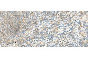 Immunohistochemistry of paraffin-embedded Human tonsil tissue using HLA-DRB4 Polyclonal Antibody at dilution of 1:60(x200)