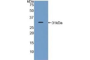 Western blot analysis of recombinant Mouse GHR. (Growth Hormone Receptor anticorps  (AA 36-266))