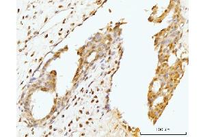 IHC analysis of Nucleostemin/GNL3 using anti-Nucleostemin/GNL3 antibody (ABIN7601778).