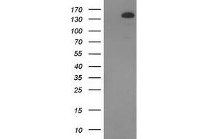 Western Blotting (WB) image for anti-TBC1 Domain Family, Member 4 (TBC1D4) antibody (ABIN1501319) (TBC1D4 anticorps)