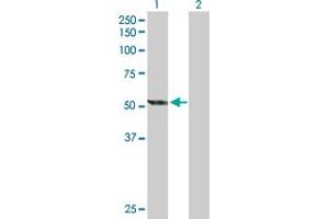 Western Blot analysis of CYP2E1 expression in transfected 293T cell line by CYP2E1 MaxPab polyclonal antibody. (CYP2E1 anticorps  (AA 1-493))