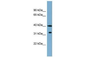 KCTD9 antibody used at 1 ug/ml to detect target protein. (KCTD9 anticorps  (Middle Region))