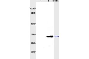 Lane 1: mouse brain lysates Lane 2: mouse kidney lysates probed with Anti CDK4 Polyclonal Antibody, Unconjugated (ABIN671166) at 1:200 in 4 °C.